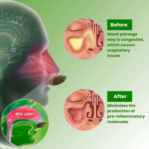 Rushify™ - Comfortable Nasal Solution