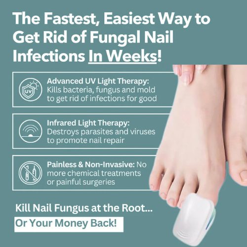RushifyNail Pro™ - Nail Fungus Laser Device
